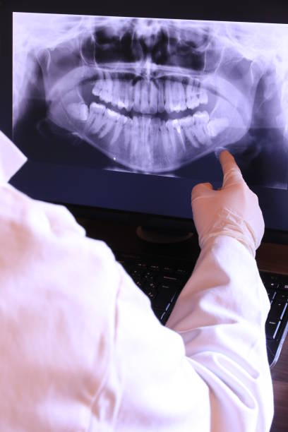 Best Emergency Tooth Extraction in Elkhart, TX