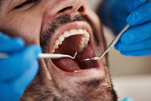 Best Same-Day Emergency Dentist in Elkhart, TX